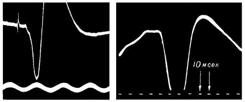 Вызванные потенциалы. Рис.