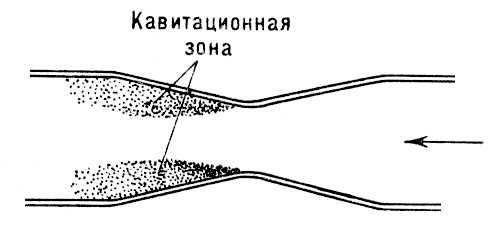 Кавитационная зона