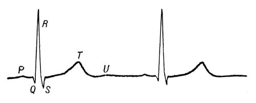 Нормальная кардиограмма