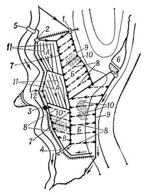 Осушительно-увлажнительная система в пойме реки (схема)