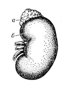 Почка человека с надпочечником