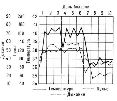 Температурная кривая при пневмонии