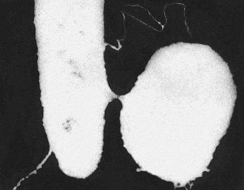 Электронномикроскопическое изображение конъюгации